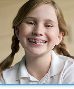 abbasi_top-nova-orthodontics-ashburn-potomac-falls-va-all-about-braces About Braces Top Nova Orthodontics Potomac Falls Ashburn VA