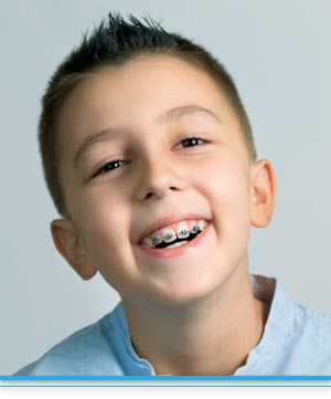 abbasi_top-nova-orthodontics-ashburn-potomac-falls-va-early-orthodontic-treatment Early Orthodontic Treatment Top Nova Orthodontics Potomac Falls Ashburn VA
