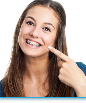 FAQ - Top Nova Orthodontist