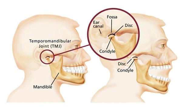 5 Symptoms of TMJ Disorder You Shouldn’t Ignore in 2023