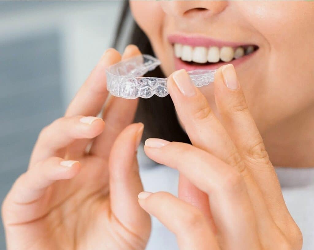 The Benefits of Clear Braces in Sterling and Invisalign - Titan Dental Care  Sterling, Virginia