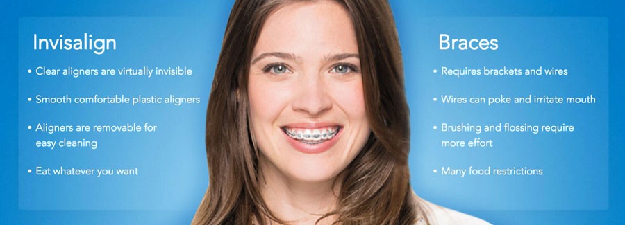 Invisalign vs. Braces: Which Orthodontic Treatment is Right for You?