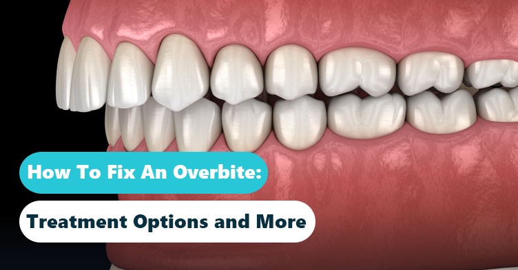 Fixing an Overbite: Effective Solutions and Treatments