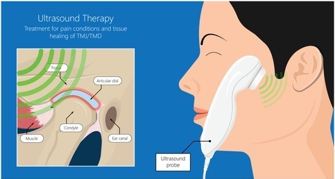 Ultrasound Therapy For TMJ: How Does It Work And Is It Effective