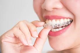 Invisalign and TMJ Relief