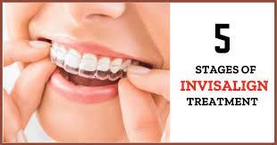 The Invisalign Treatment Process