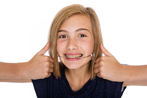 Smiling With Headgear