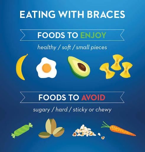 Foods With Braces